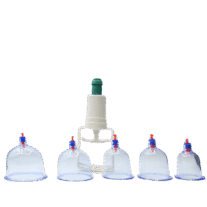 Hijama 2